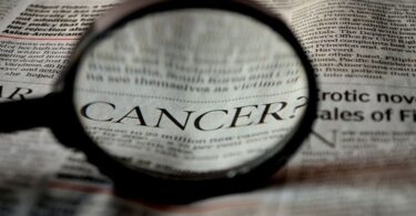 Beberapa Hal yang Perlu Diketahui Mengenai Kanker